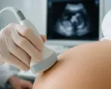 Pierwsze spojrzenie na maluszka! 9 tydzień ciąży, USG 3D pokazuje jego maleńką postać.