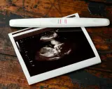USG 7 tydzień ciąży pokazuje zarodek. Obok leży pozytywny test ciążowy.