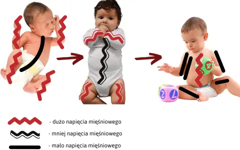 Zmiana napięcia mięśniowego u niemowląt: od wzmożonego napięcia obręczy barkowej do swobodniejszych ruchów.